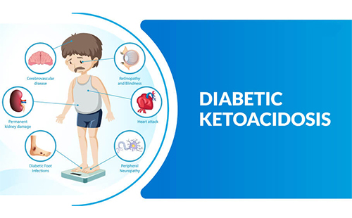 consultant-diabetic-ketoacidosis