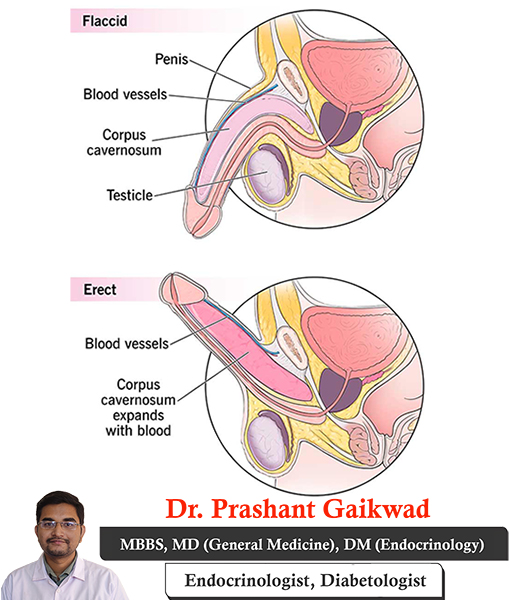 dr-prashant-gaikwad-erectile-dysfunction-consultant