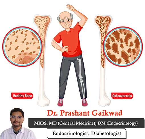 Dr. Prashant Gaikwad, Type 1 Diabetes Consultant, offering guidance on managing low and high blood sugar levels